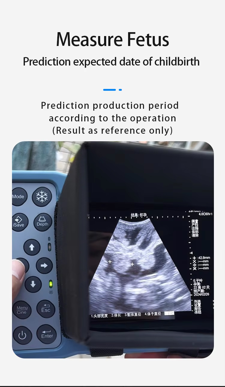 Veterinary Livestock Ultrasound Machine Veterinary Livestock Ultrasound Machine